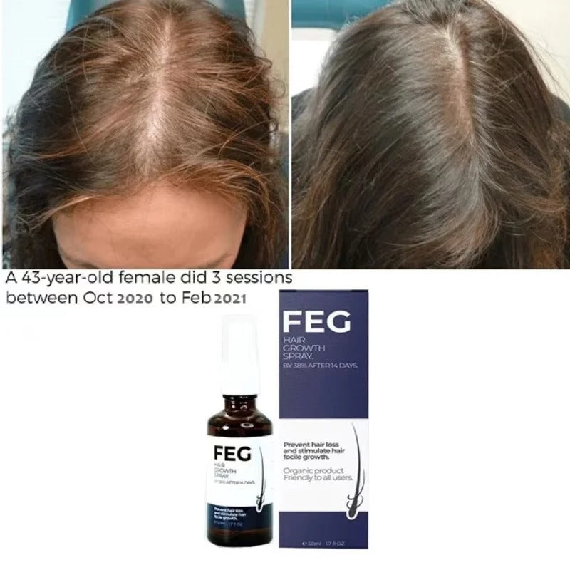 FEG PLUS Hair Growth Spray 50ml