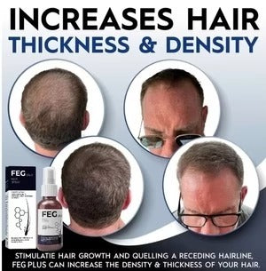 FEG PLUS Hair Growth Spray 50ml