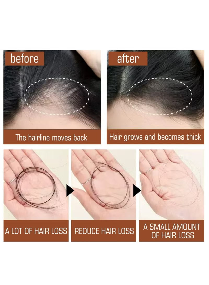 60ml Hair Growth Spray & Beard Roller – 5% Minoxidil Serum for Hair & Beard Growth, Hair Loss Treatment